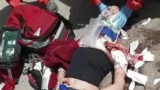 كلاب تنهش جسد وشعر شابة في اهدن